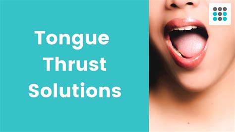 tongue thrust solutions l qanda with dr bailey youtube