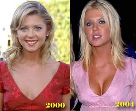 Celebrity Plastic Surgery Before And After 56 Pics Tara Reid Celebrities Before And After