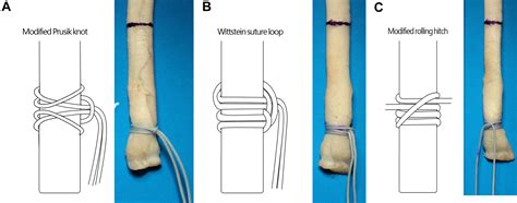 Evaluation Of Needleless Grasping Suture Techniques For Soft Tissue