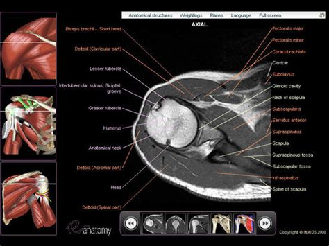 Shoulder Mri Radiographical And Illustrated Anatomical Atlas