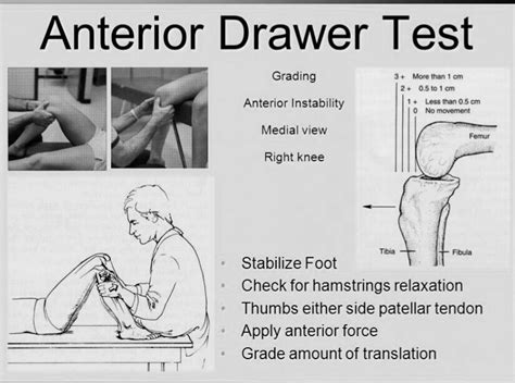 Knee Examination Pt Master Guide