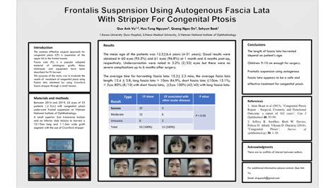 Pdf Frontalis Suspension Using Autogenous Fascia Lata With Stripper