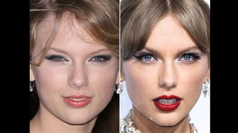 Taylor Swift Plastic Surgery Truth Revealed