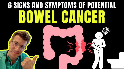 6 Signs And Symptoms Of Bowel Cancer Youtube
