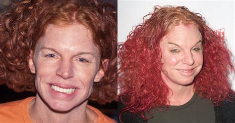 Carrot Top Plastic Surgery Disasters Purple Clover