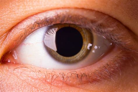 Drugs And Dilated Pupils Causes And Risks Bhopb