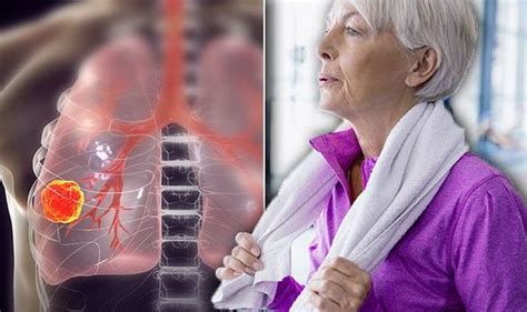 Lung Cancer Symptoms Signs Of Tumour Include Breath Noise Uk