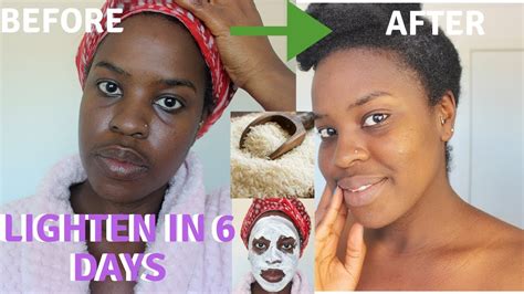 How I How I Brightened My Skin In 6 Days Realistic And Natural Way To