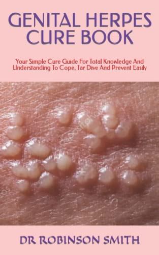 Genital Herpes Cure Book Your Simple Cure Guide For Total Knowledge And Understanding To Cope