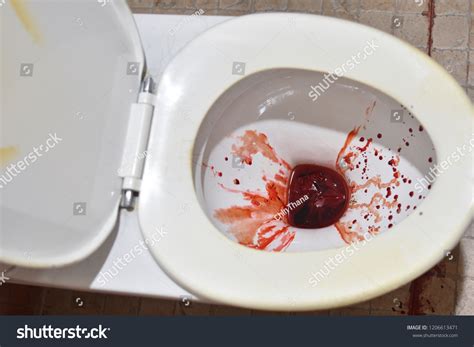 Стоковая фотография 1206613471 Splattered Blood Toilet Bowl