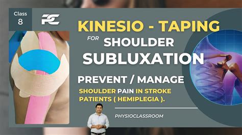 Kinesio Taping For Hemiplegic Shoulder Pain Subluxation Youtube