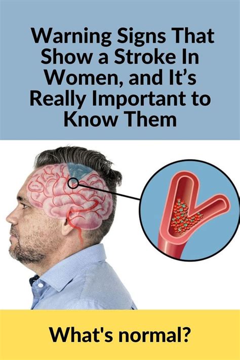 9 Warning Signs That Show A Stroke In Women And Its Really Important To Know Them In 2021