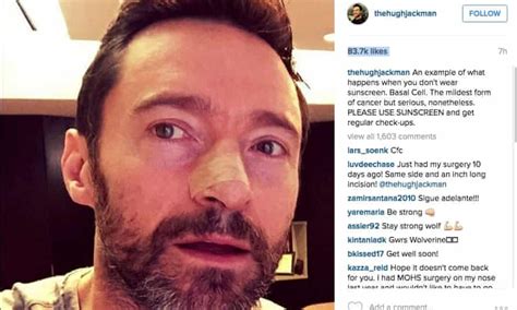 Hugh Jackman Posts Sun Safety Appeal After Getting Skin Cancer Removed