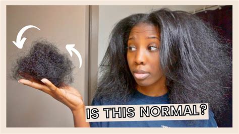 I Lost So Much Hair Excessive Shedding Help Youtube