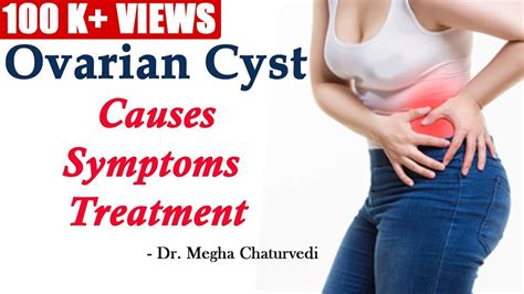 Ovarian Cyst Causes Symptoms And Treatment Youtube