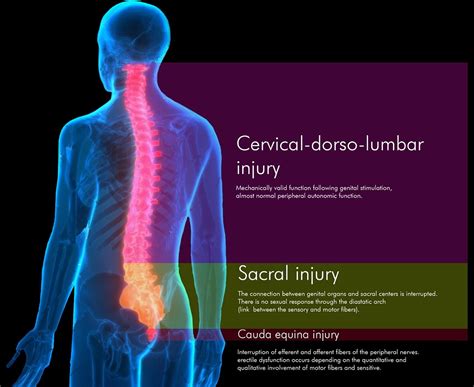 Sexual Dysfunction In Male Individuals With Spinal Cord Iniury What Do We Know So Far