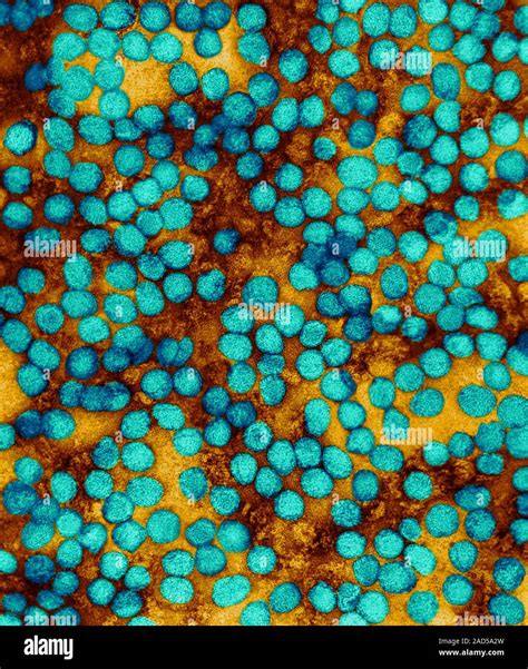 Las Partículas De Virus De La Fiebre Amarilla Viriones Color