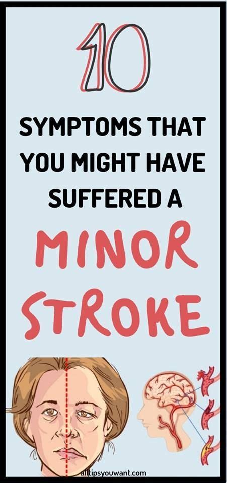 Stroke Understanding Indicators And Symptoms As Well As Exactly How To Get Rid Of Normally And