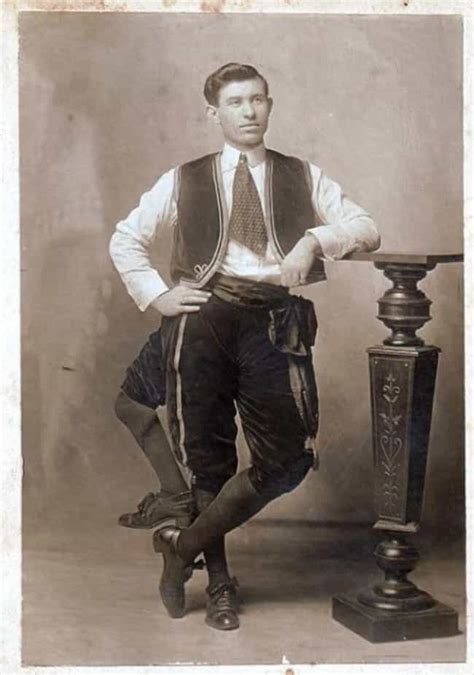 The Strange Life Of Frank Lentini The Three Legged Wonder