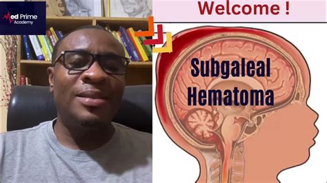 Subgaleal Hematoma Explained In Brief Youtube