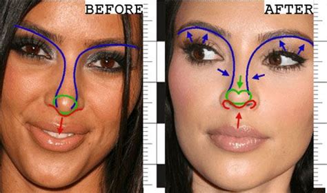 Kim Kardashian Nose Job Before And After Kardashian Plastic Surgery