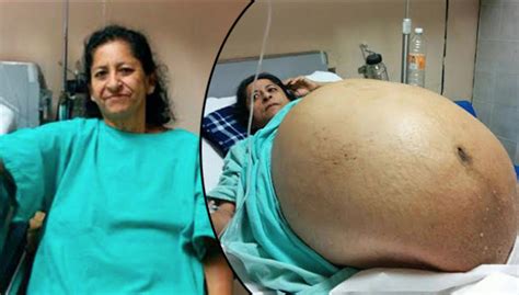 At First She Thought She Was Pregnant But Her Belly Never Stopped