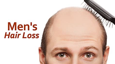 There are clinically proven ways to regrow hair. Men's Hair Loss - YouTube