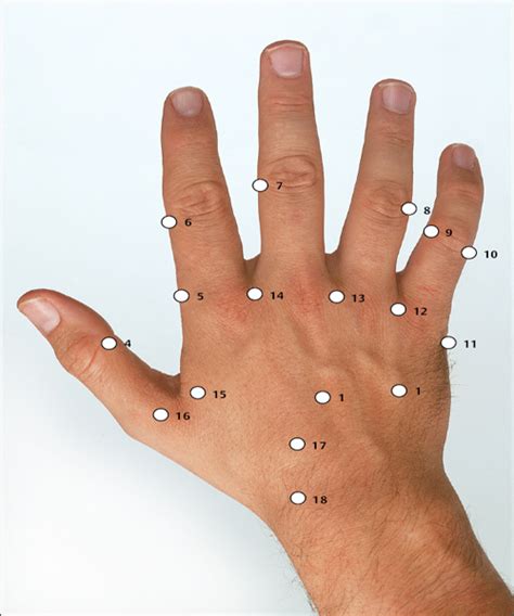 Chinese Hand Acupuncture Musculoskeletal Key