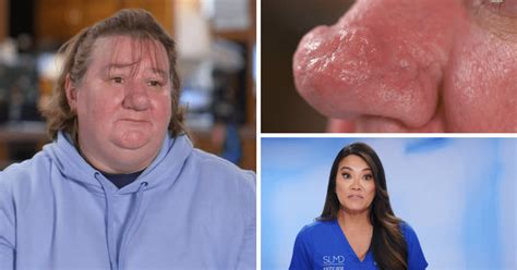 Dr Pimple Popper Season 9 Where Is Teresa Now Dr Sandra Lees