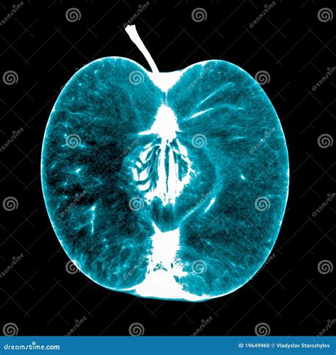 X Ray Of The Apple Stock Photo Image Of Meal Food Fruit 19649960