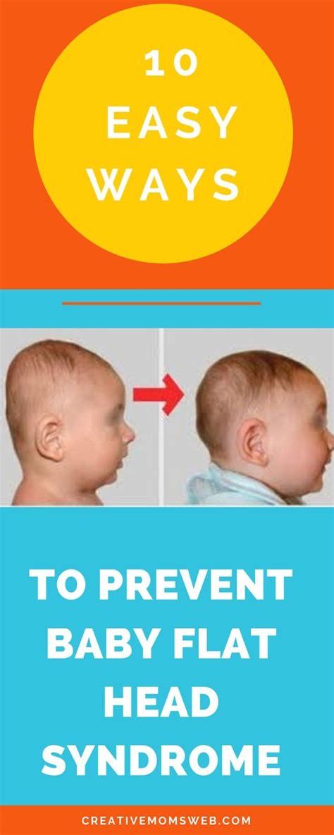 5 Easy Way To Prevent The Flat Head Syndrome Flat Head Baby Flat