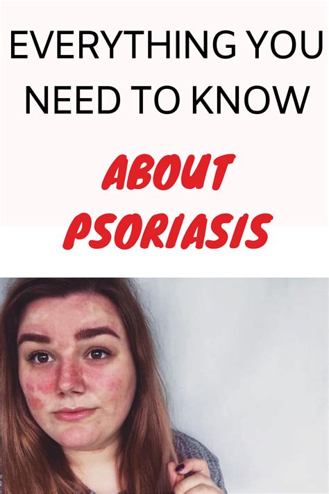 Everything You Need To Know About Psoriasis