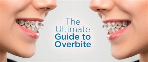 The Difference Between Overjet And Overbite Hawthorn East Dental