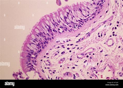 Epithelial Tissue Of Trachea Tracheal Epithelium Stock Photo Alamy