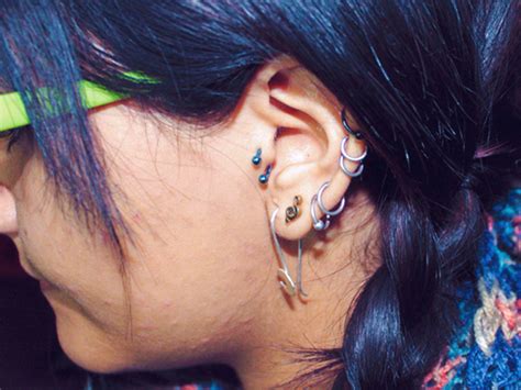 Cartilage Piercing Bump Keloid Infection Treatment And More