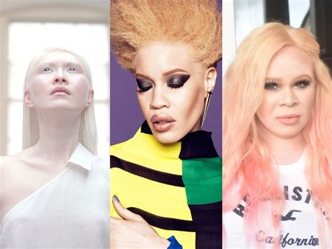 3 Women With Albinism Share Their Makeup Routines Self