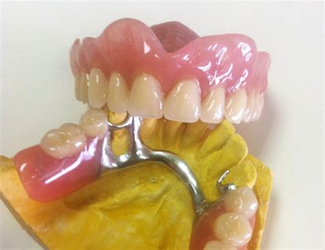 Los Distintos Tipos De Dentaduras Postizas Clínica Larrañaga