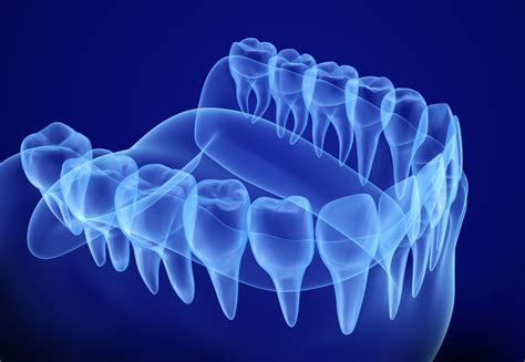 Radiología Digital Nuestros Servicios De Bonestar Clínica Dental