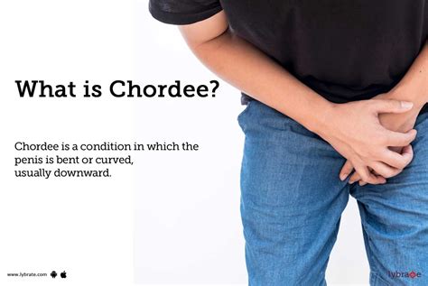Chordee Causes Symptoms Treatment And Cost