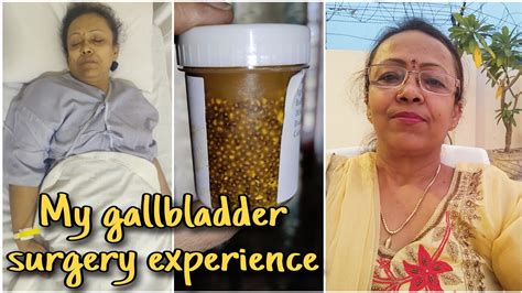 Gallbladder Surgery Experience मैंने पित की थैली का ऑपरेशन क्यों कराया