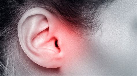 ¿ruido En Los Oídos Descubre Qué Es El Tinnitus