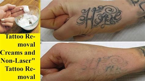 How To Remove Tattoo Permanently Best Answer 2024