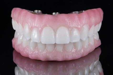 'sadaqah' literally means 'righteousness' and refers to the voluntary giving of alms or charity. What are the Different Types of Dentures? | Stanley Dentistry