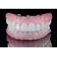 What Are The Different Types Of Dentures  Stanley Dentistry