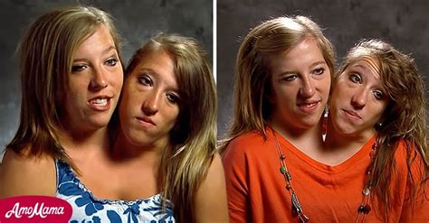 All We Know About World Famous Conjoined Twins Abby And Brittany Hensels Private Lives And Careers