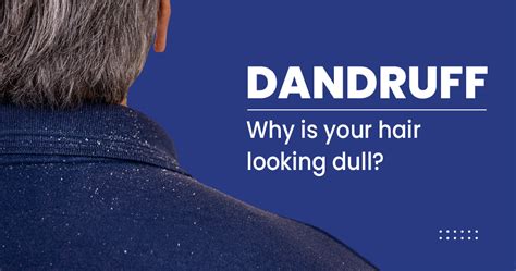 Dandruff Causes Symptoms And Treatments Star Health