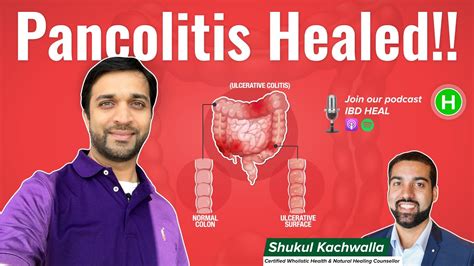How To Heal Pancolitis Shishirs Testimonial Youtube