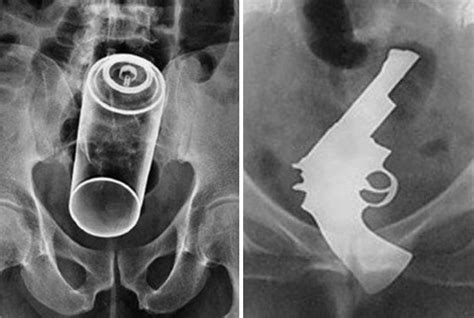 Strange X Rays Pictures Hot Sex Picture