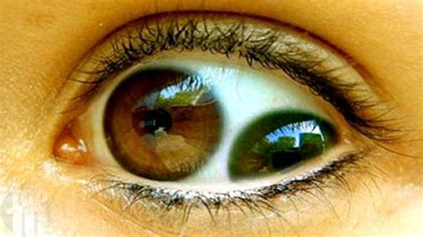 10 People With The Most Unusual Eyes Youtube