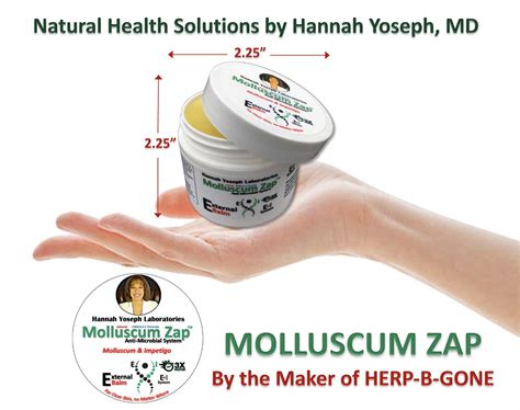 Buy Molluscum Contagiosum Treatment Cream For Molluscum Impetigo